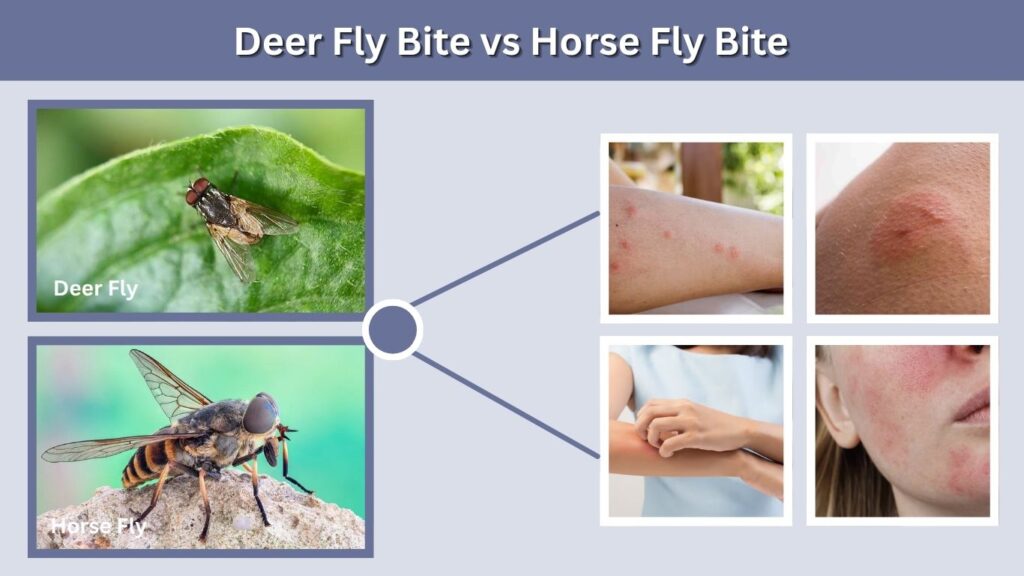 Deer Fly Bite vs Horse Fly Bite