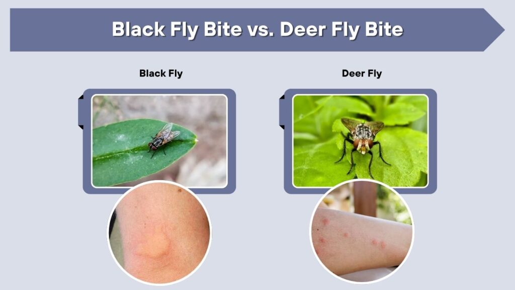 Black Fly Bite vs. Deer Fly Bite