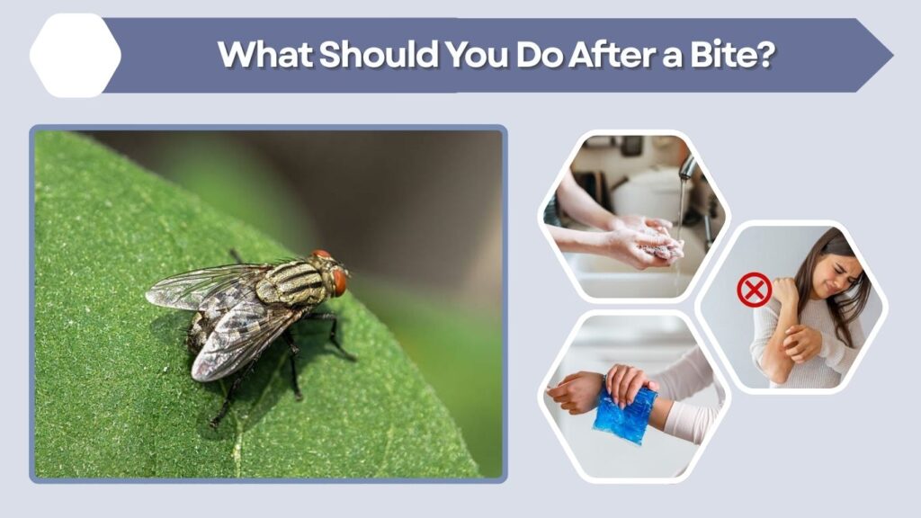 What Should You Do After a Bite?