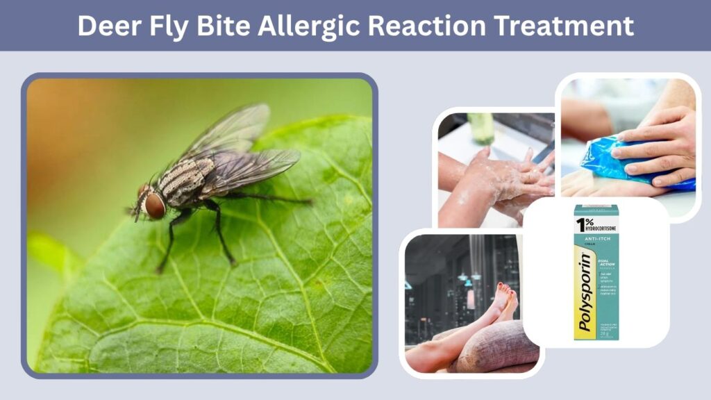 Deer Fly Bite Allergic Reaction Treatment