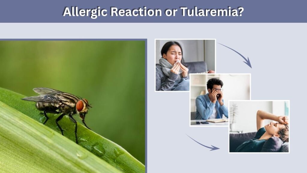 Allergic Reaction or Tularemia?