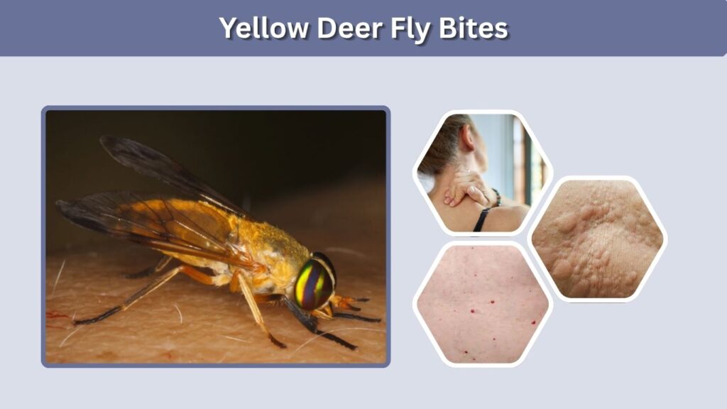Yellow Deer Fly Bites