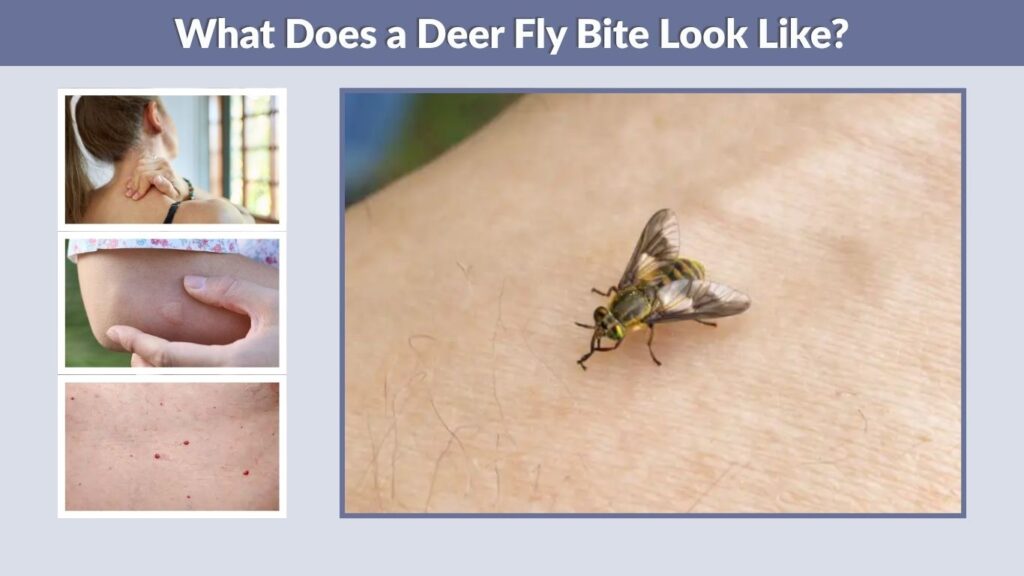 What Does a Deer Fly Bite Look Like?