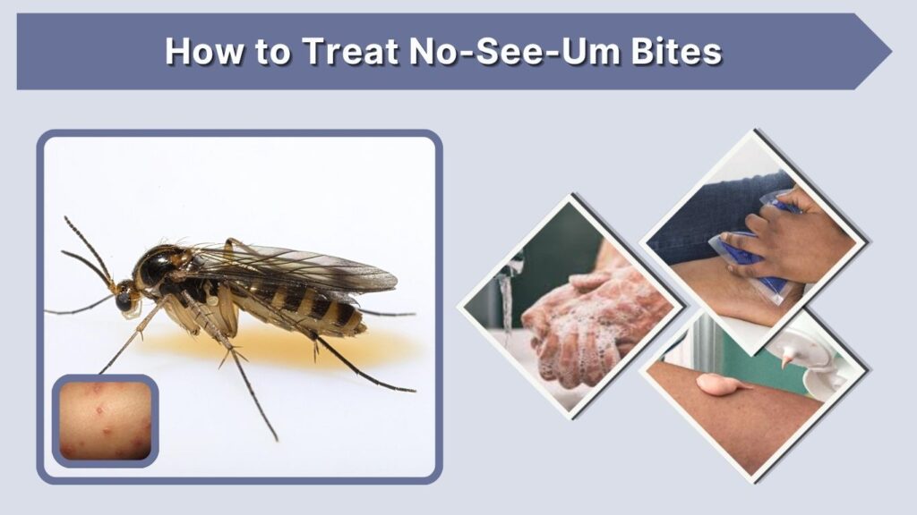 How to Treat No-See-Um Bites