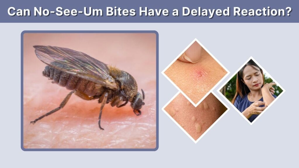 Can No-See-Um Bites Have a Delayed Reaction?