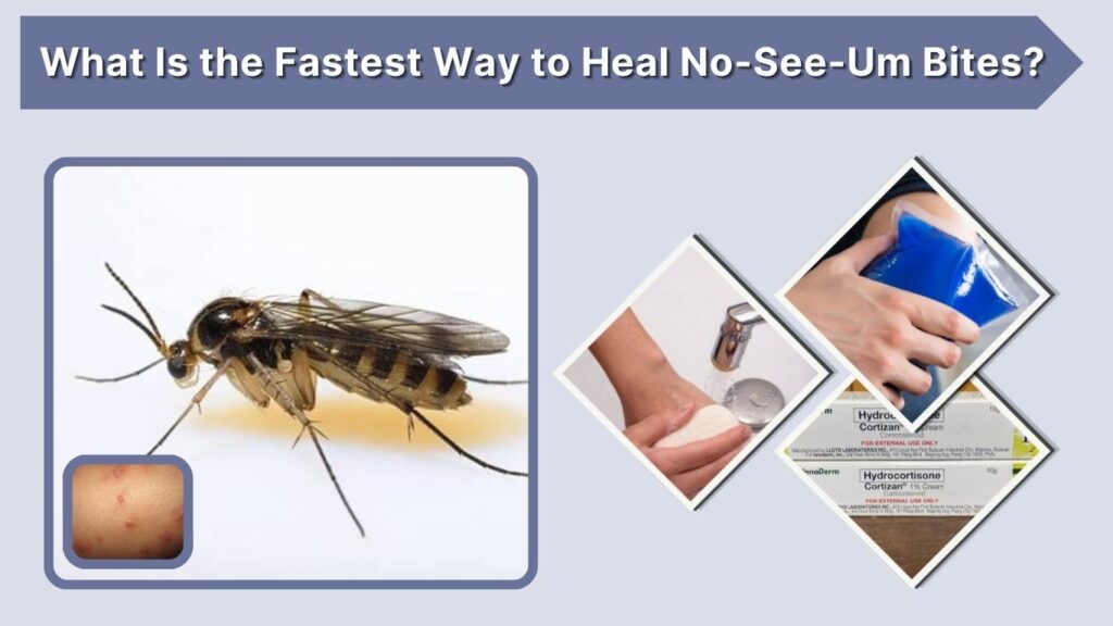 What Is the Fastest Way to Heal No-See-Um Bites?
