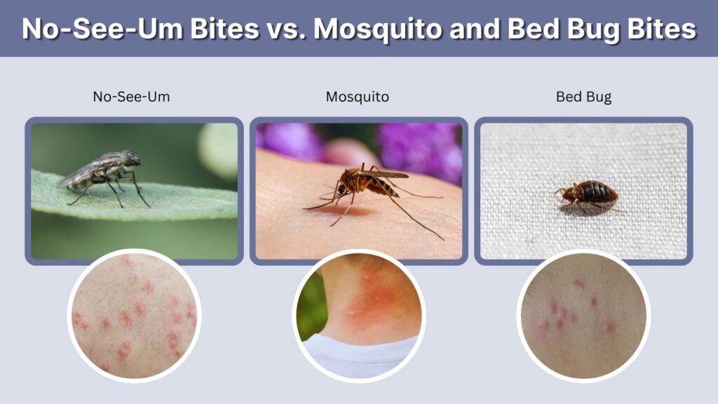 No-See-Um Bites vs. Mosquito and Bed Bug Bites
