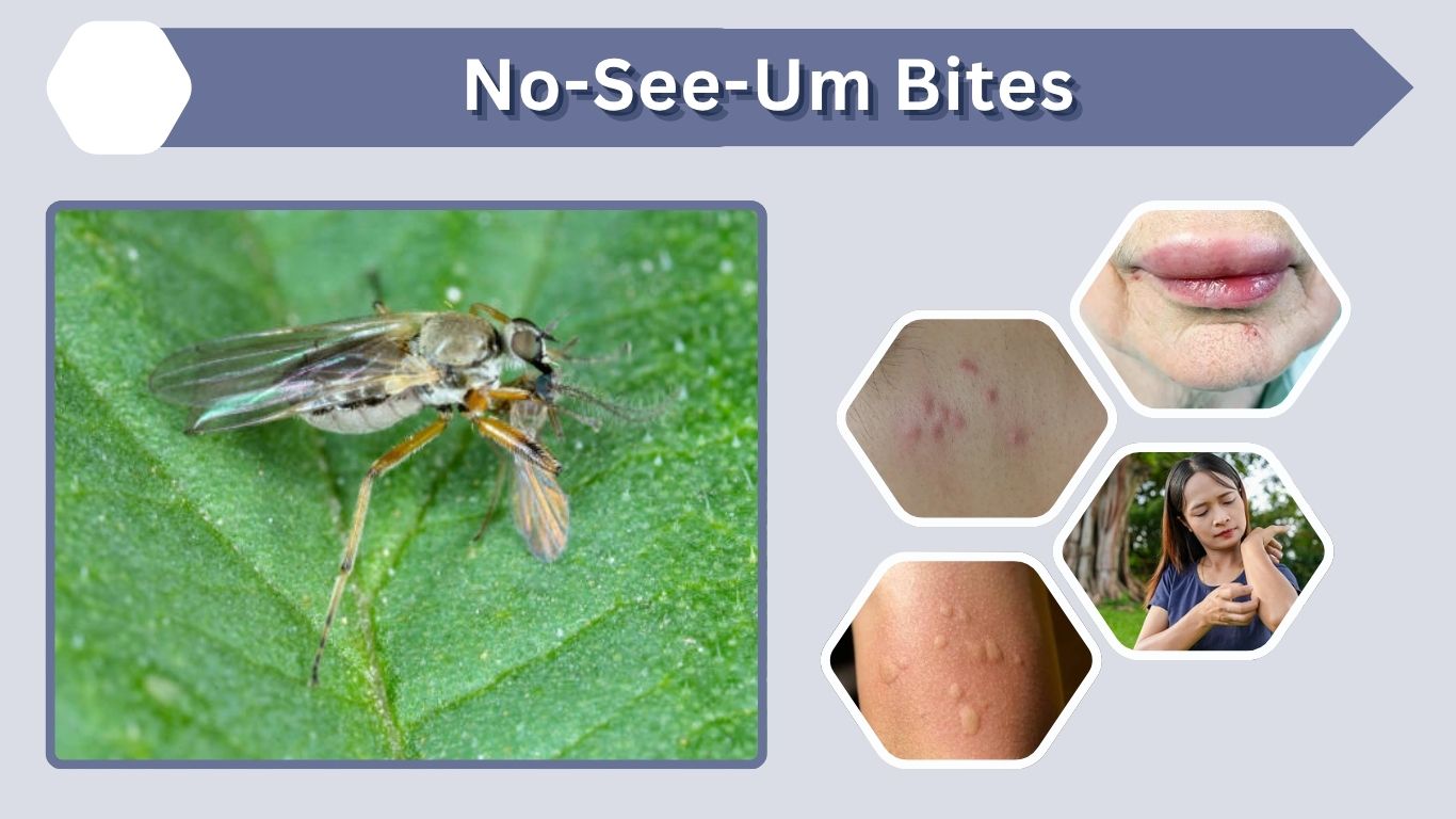 No-See-Um Bites: Appearance, Treatment and Fast Relief