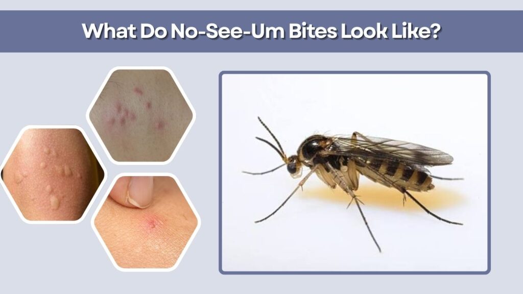 What Do No-See-Um Bites Look Like?