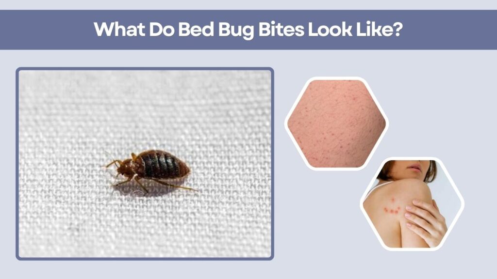 What Do Bed Bug Bites Look Like?