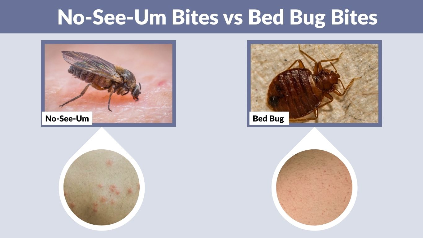 No-See-Um Bites vs Bed Bug Bites: How to Tell the Difference