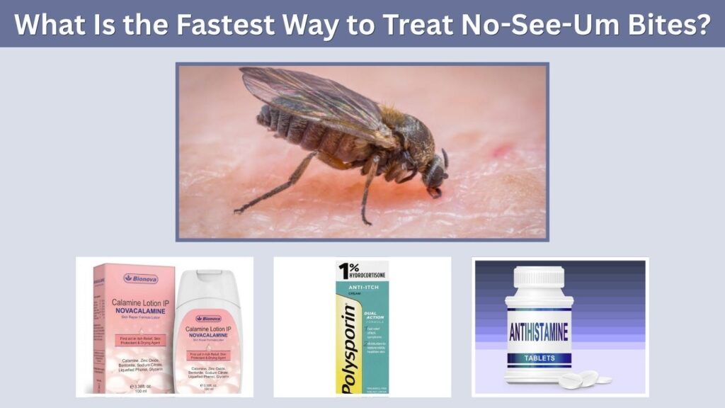 What Is the Fastest Way to Treat No-See-Um Bites?