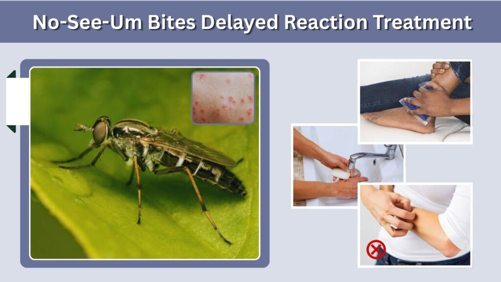 No-See-Um Bites Delayed Reaction Treatment