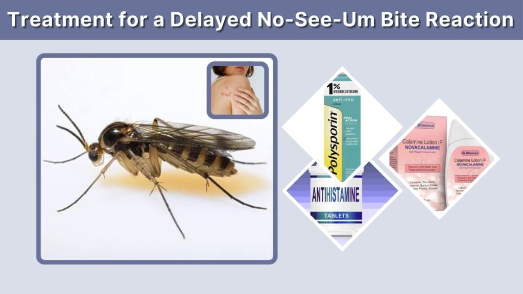 Treatment for a Delayed No-See-Um Bite Reaction