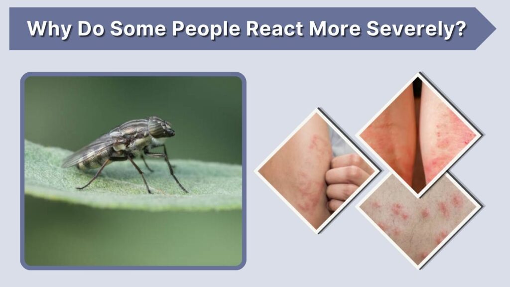Why Do Some People React More Severely?
