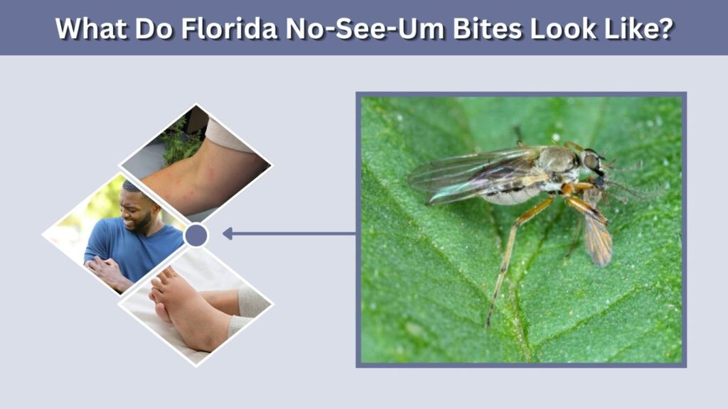 What Do Florida No-See-Um Bites Look Like?