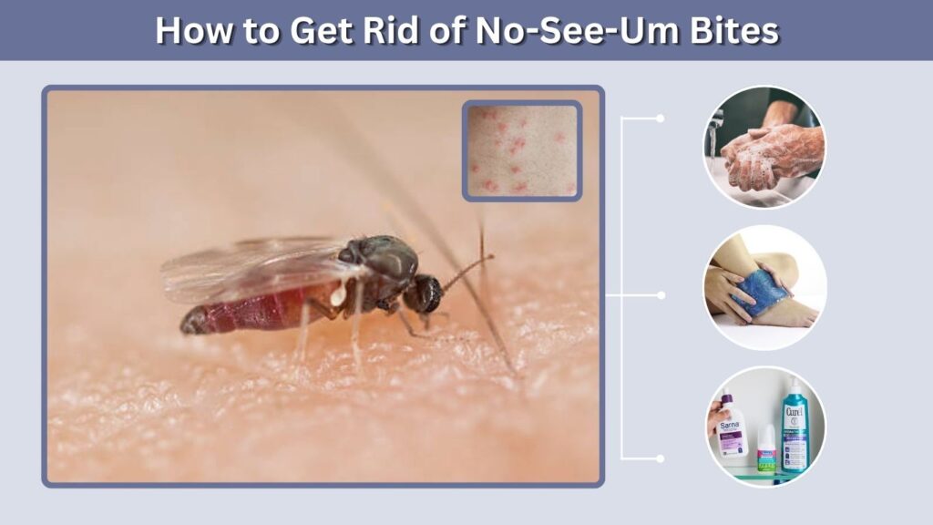 How to Get Rid of No-See-Um Bites