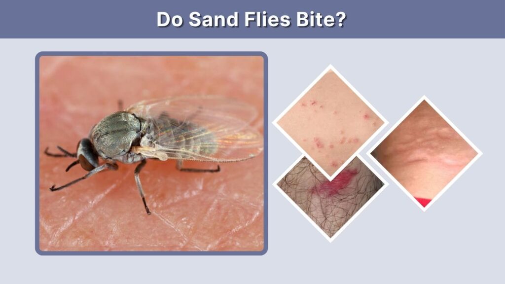 Do Sand Flies Bite?