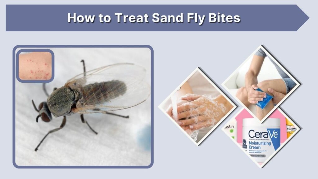 How to Treat Sand Fly Bites