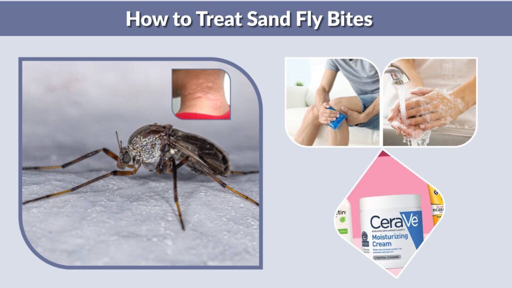 How to Treat Sand Fly Bites