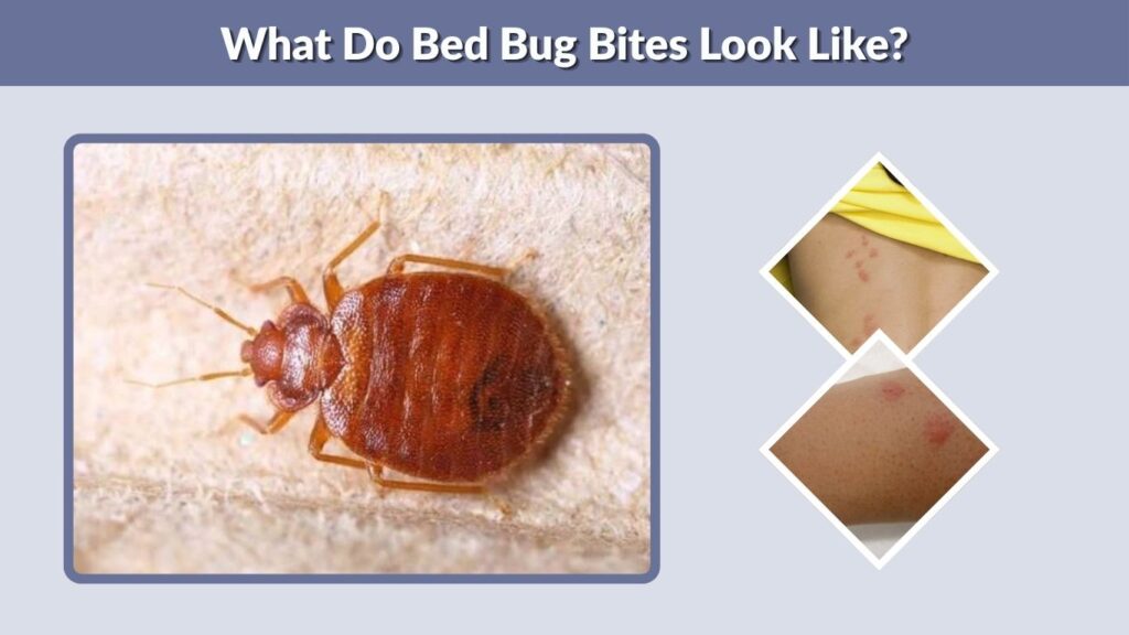 What Do Bed Bug Bites Look Like?