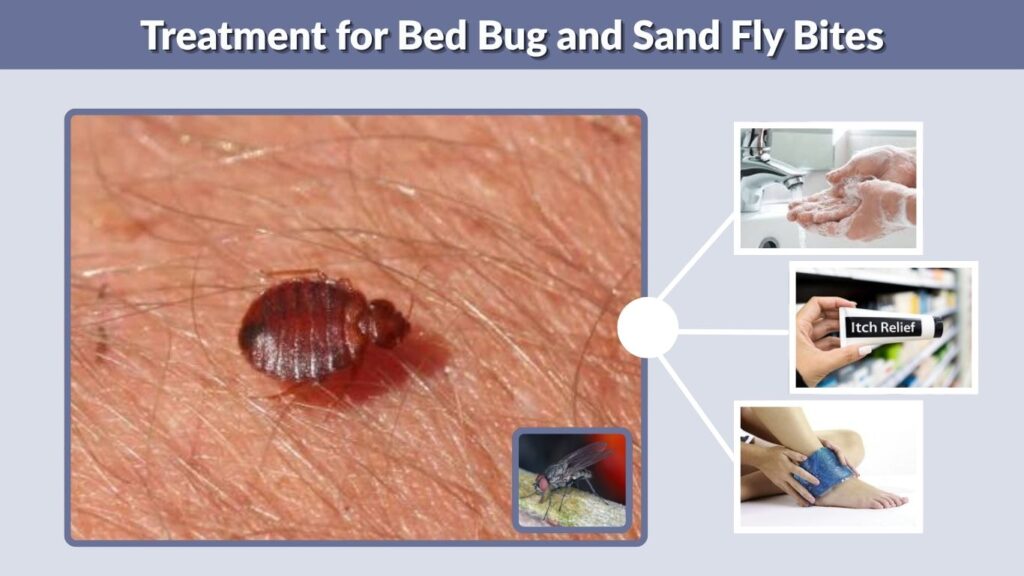 Treatment for Bed Bug and Sand Fly Bites
