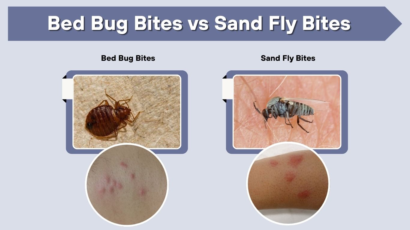 Bed Bug Bites vs Sand Fly Bites: How to Tell the Difference