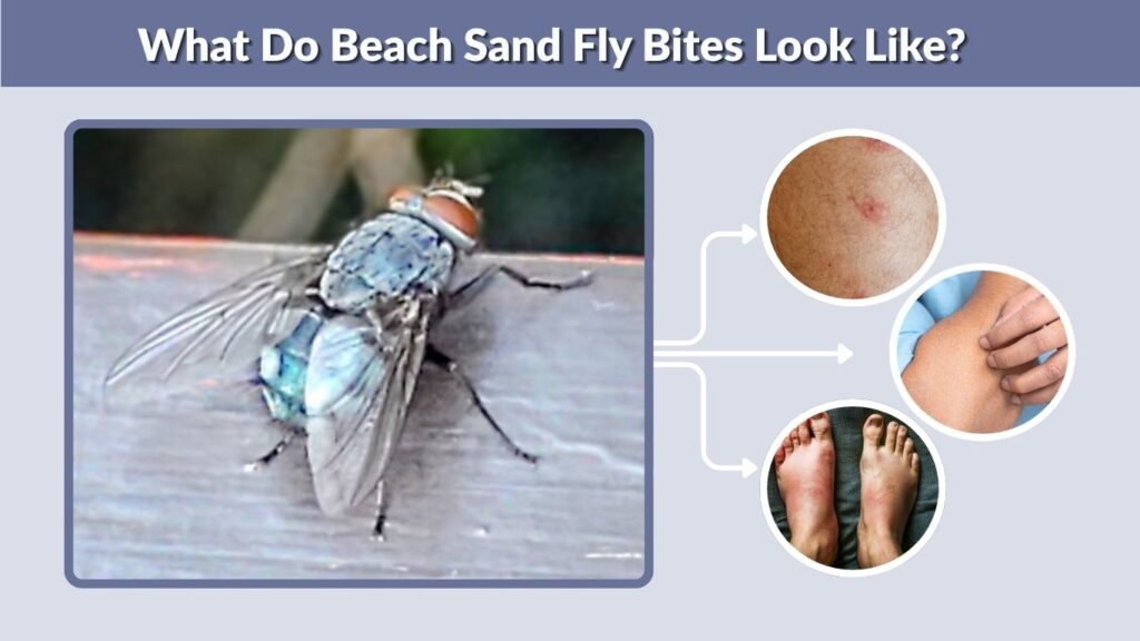 What Do Beach Sand Fly Bites Look Like?