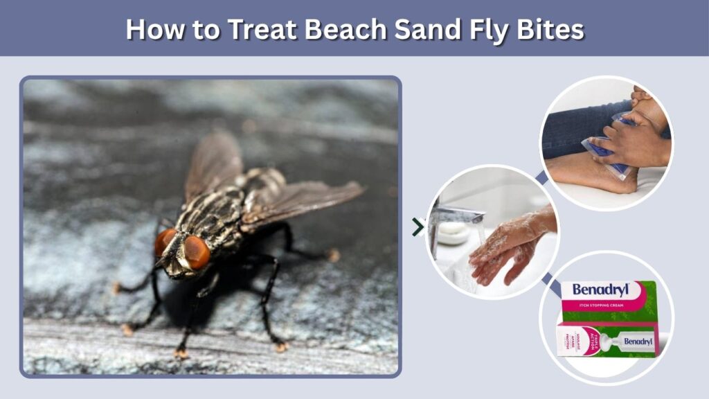 How to Treat Beach Sand Fly Bites