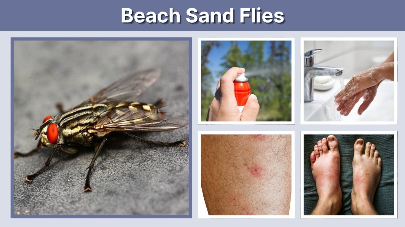 Beach Sand Flies: Bites, Prevention and Treatment