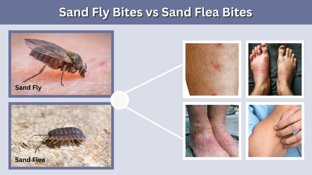 Sand Fly Bites vs Sand Flea Bites