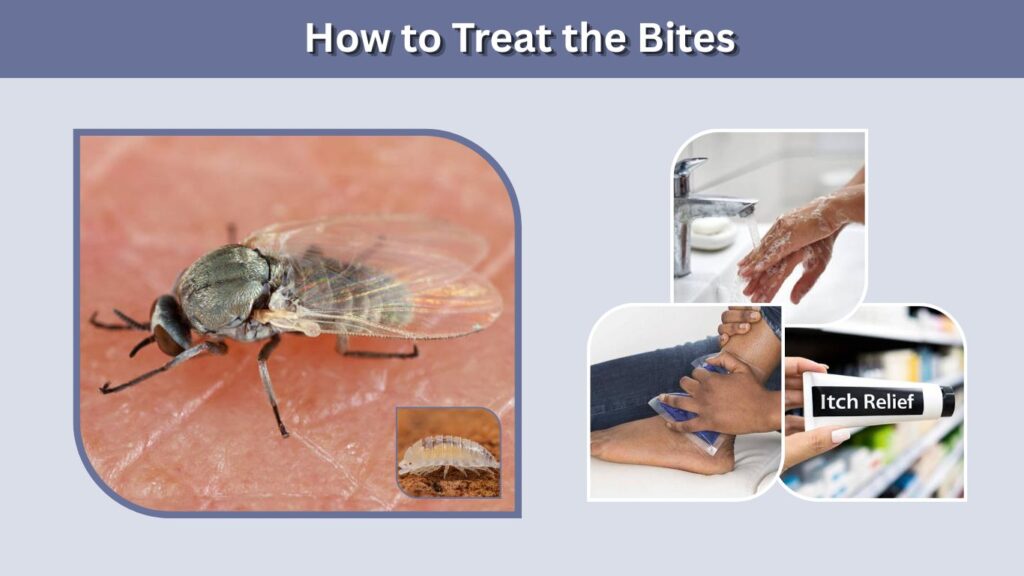 How to Treat the Bites