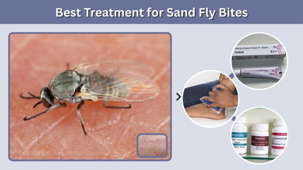 Best Treatment for Sand Fly Bites