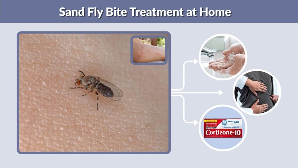 Sand Fly Bite Treatment at Home