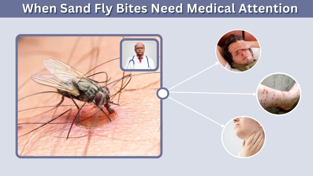 When Sand Fly Bites Need Medical Attention