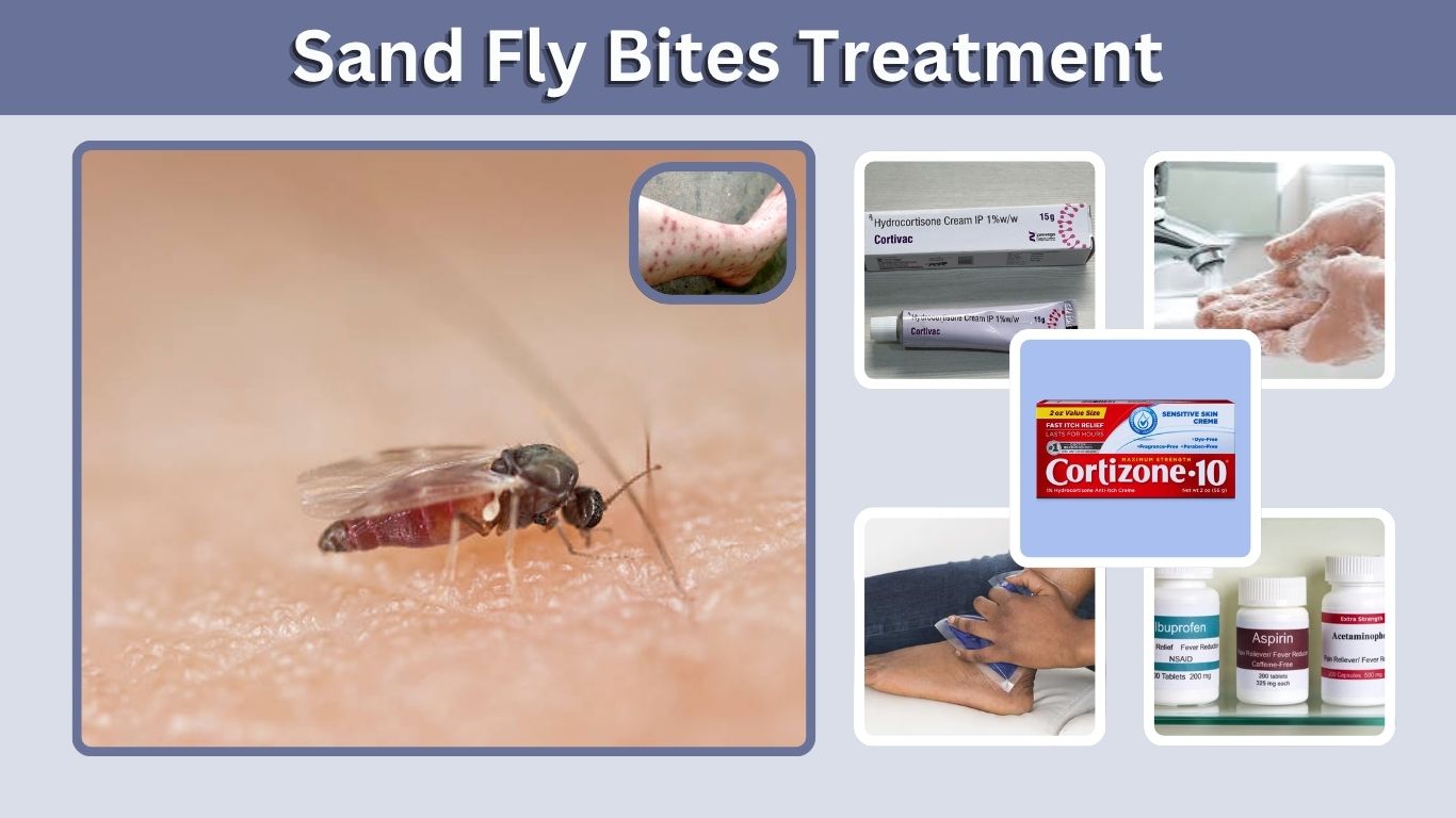 Sand Fly Bites Treatment: Fast Relief and Home Remedies