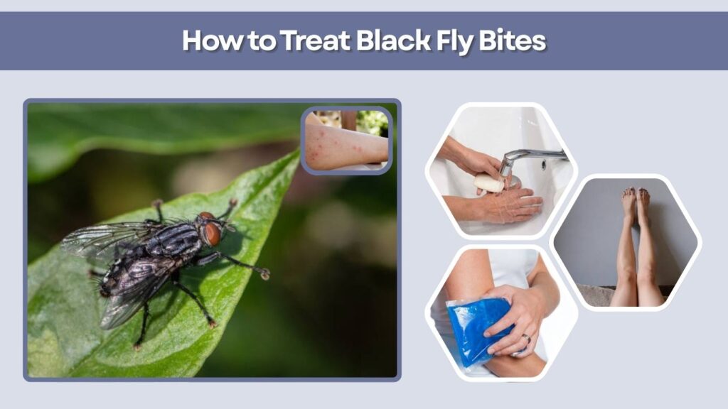 How to Treat Black Fly Bites