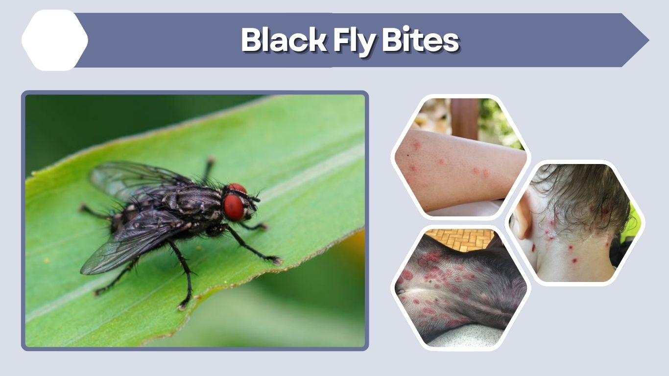 Black Fly Bites: Symptoms, Treatment, and Prevention