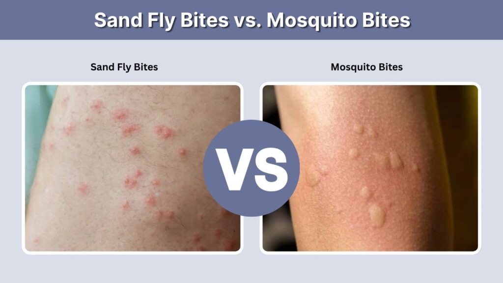 Sand Fly Bites vs. Mosquito Bites