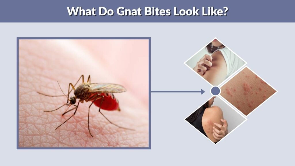 What Do Gnat Bites Look Like?