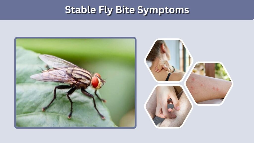 Stable Fly Bite Symptoms