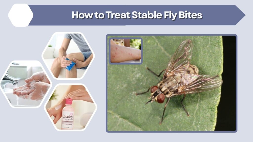 How to Treat Stable Fly Bites