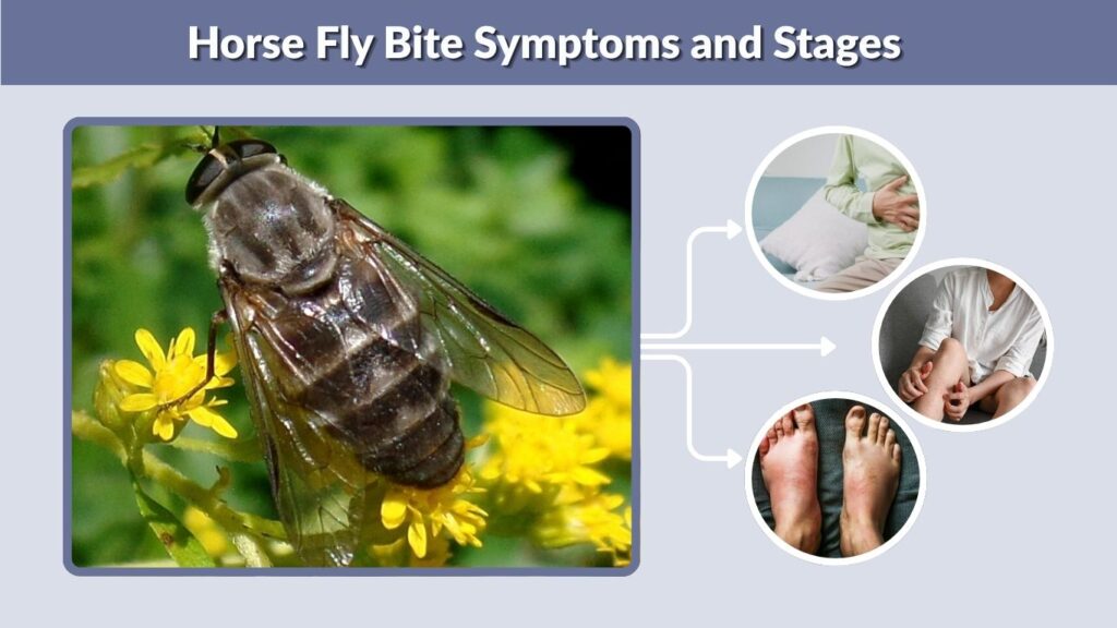 Horse Fly Bite Symptoms and Stages