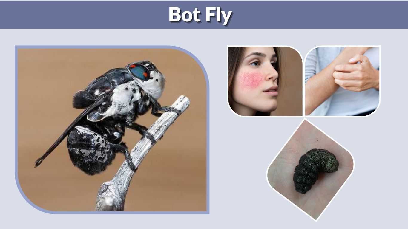 Bot Fly: Larvae, Human Infestation, Removal, and Life Cycle