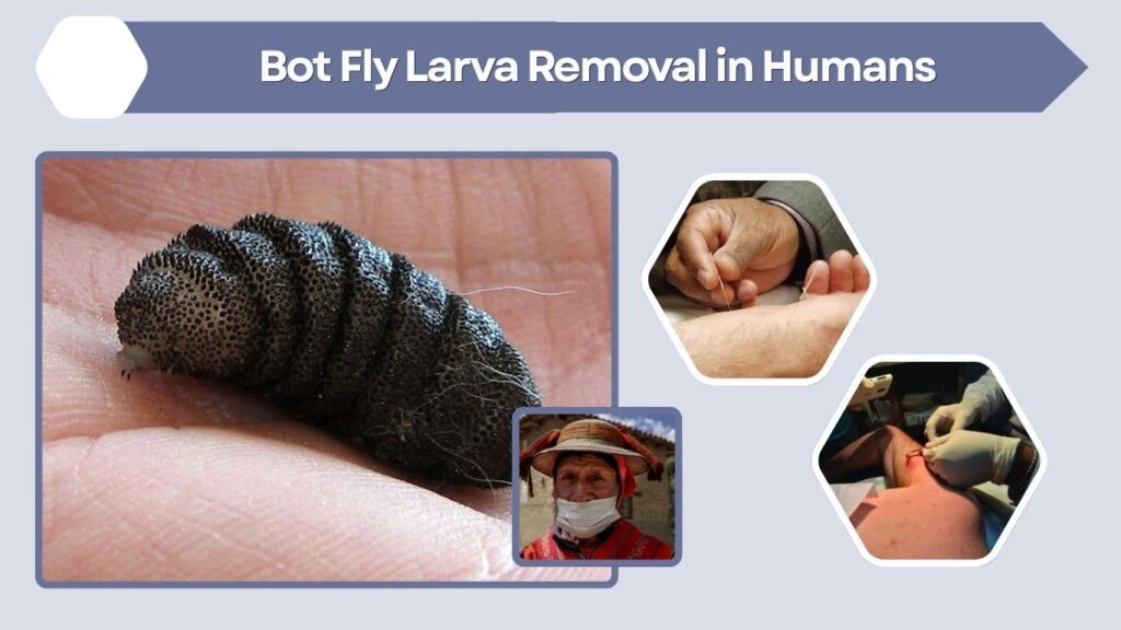 Bot Fly Larva Removal in Humans