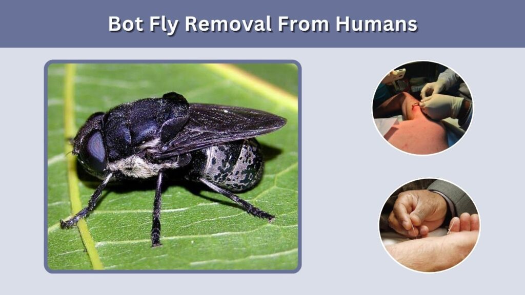 Bot Fly Removal From Humans